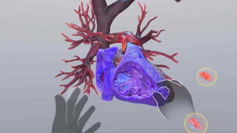 Understanding Heart Attack