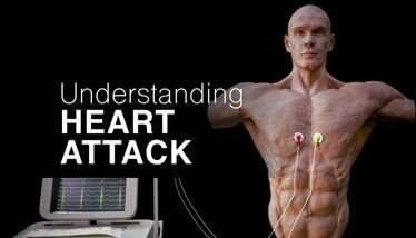 Understanding Heart Attack Oculus Meta Quest VR Game<span class="mi-jiaobiao" style="background-color: #ff0000;">Education VIP</span>