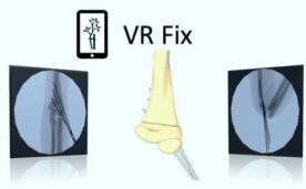 Fix Supra Oculus Meta Quest VR Game<span class="mi-jiaobiao" style="background-color: #ff0000;">Medical VIP</span>